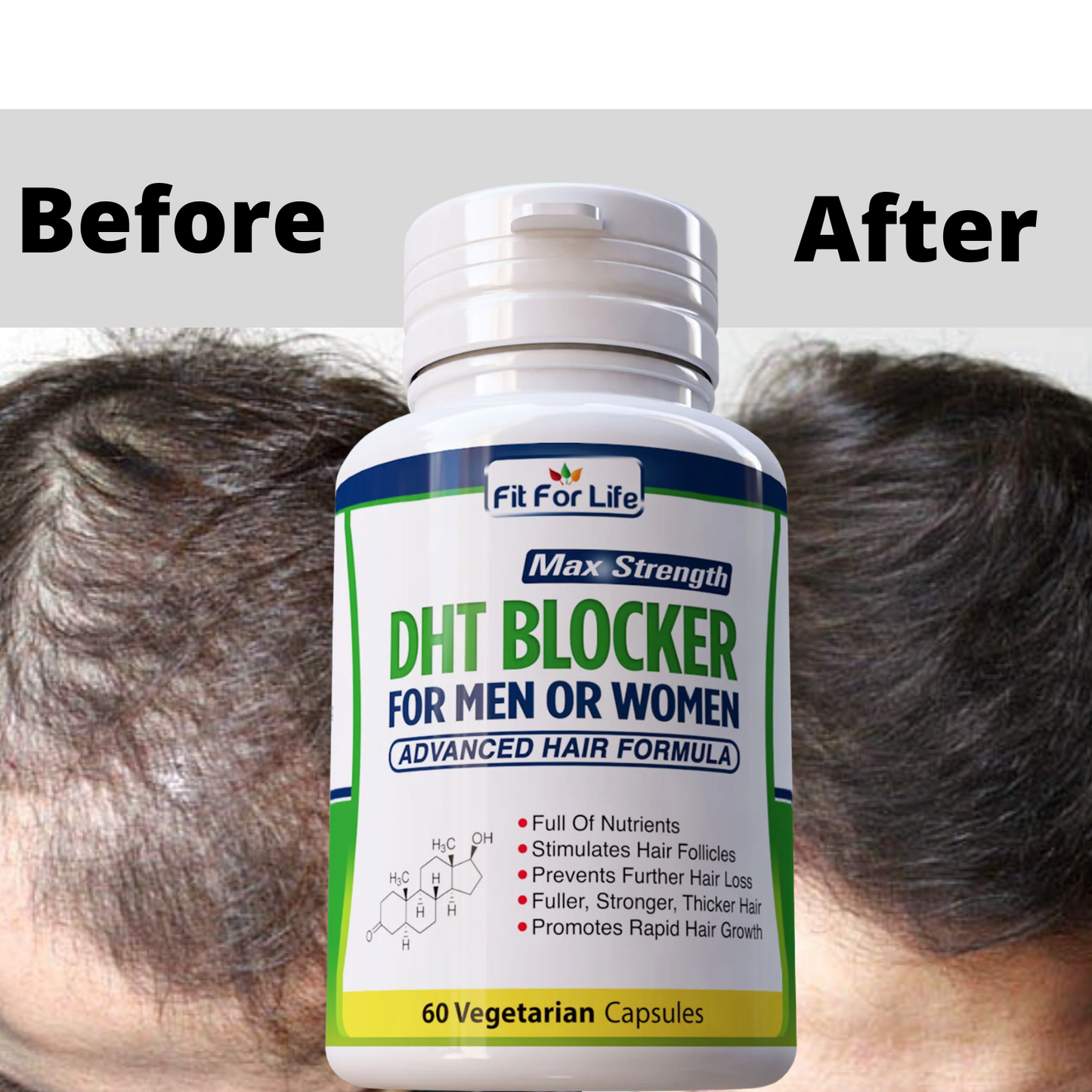 DHT Blocker- Advanced Hair Formula